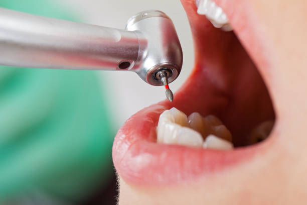 Best Urgent Tooth Repair  in Bennettsville, SC